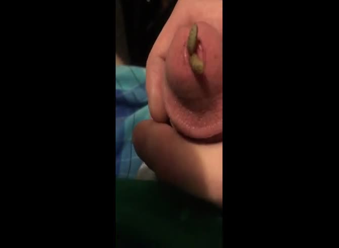 Video :Nasty dude with worms inside his dick
